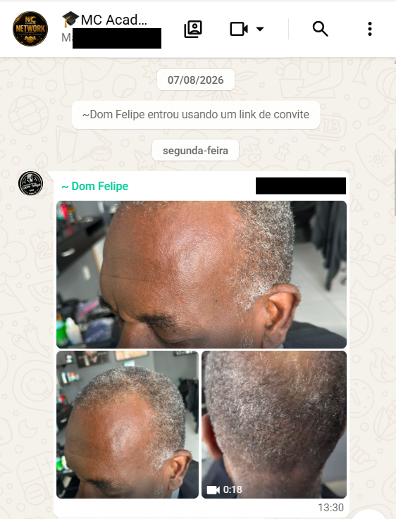 Antes da primeira aplicação de prótese realizada por Dom Felipe